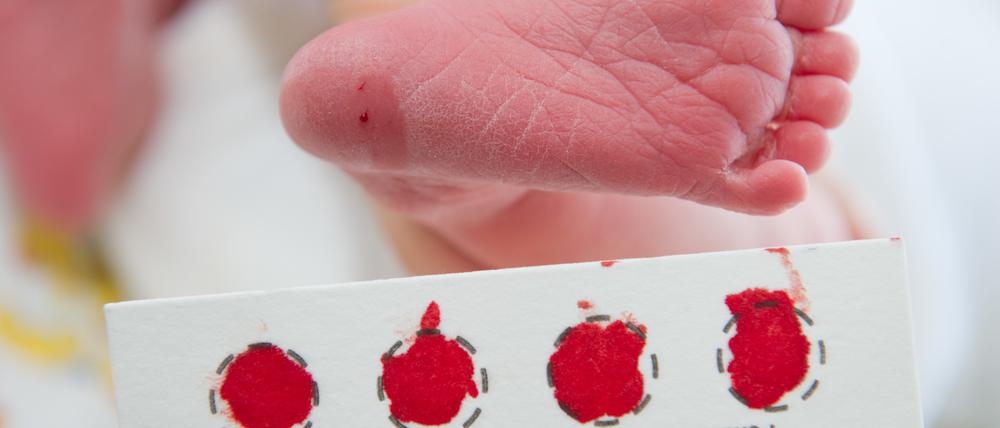 ARCHIV - An der Universitätsklinik in Greifswald (Mecklenburg-Vorpommern) wird am 31.03.2014 am Fuß eines Babys Blut für ein Neugeborenen-Screening abgenommen. Neugeborene in Mecklenburg-Vorpommern, im polnischen Westpommern und im nördlichen Brandenburg werden künftig im Rahmen der Früherkennung auf zusätzliche Erkrankungen untersucht. (zu dpa «Neugeborenen-Screening wird ausgeweitet: 45 000 Babys profitieren» vom 29.11.2017) Foto: Stefan Sauer/dpa-Zentralbild/dpa +++(c) dpa - Bildfunk+++ | Verwendung weltweit