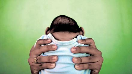 Ungewisse Zukunft. Wie sich die Zika-Babys mit ihren kleinen Köpfen entwickeln werden, weiß derzeit noch niemand.
