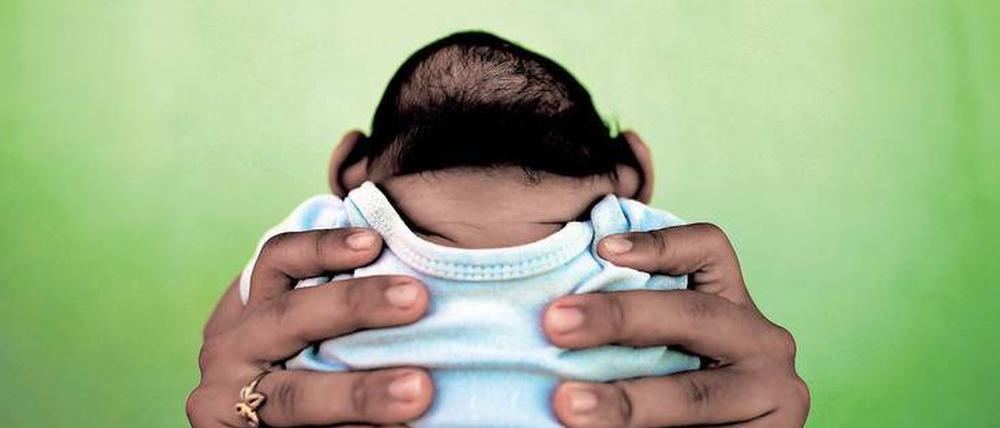 Ungewisse Zukunft. Wie sich die Zika-Babys mit ihren kleinen Köpfen entwickeln werden, weiß derzeit noch niemand.