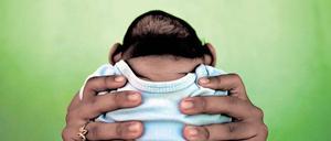 Ungewisse Zukunft. Wie sich die Zika-Babys mit ihren kleinen Köpfen entwickeln werden, weiß derzeit noch niemand.