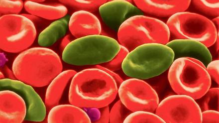 Blutkrebsmedikamente sollen das ungehemmte Wachstum bestimmter Blutzelltypen stoppen. Eine Kombination des Wirkstoffs Idelalisib mit Rituximab oder Bendamustin scheint nun tödliche Nebenwirkungen zu verursachen.