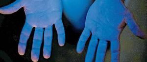 Gründlich. Schwarzlicht offenbart die richtige Händehygiene. Nur sie Stellen, die das Desinfektionsmittel erreicht hat, leuchten blau.