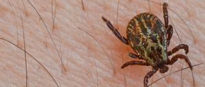 Eine Auwaldzecke krabbelt über den behaarten Arm eines Mannes.