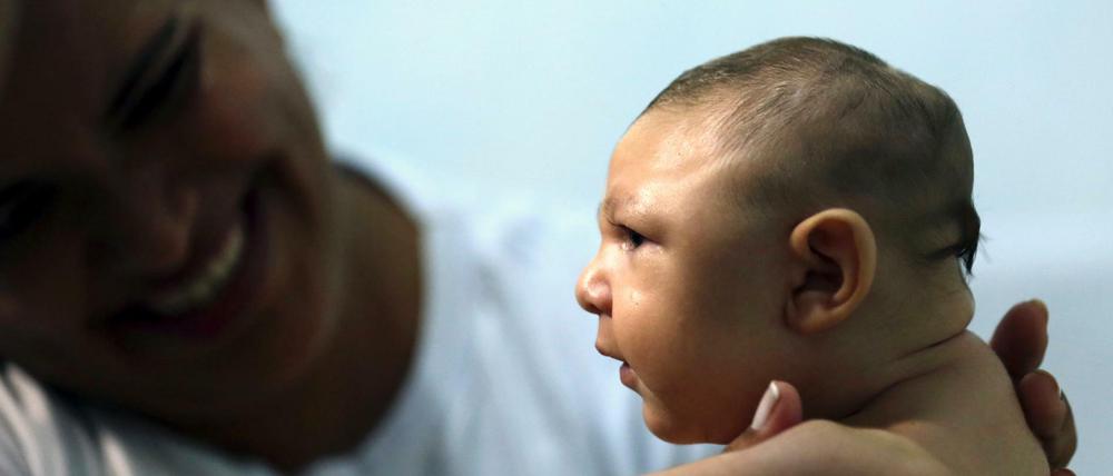 US-Forscher halten das Zika-Virus für die Ursache von Schädelfehlbildungen.