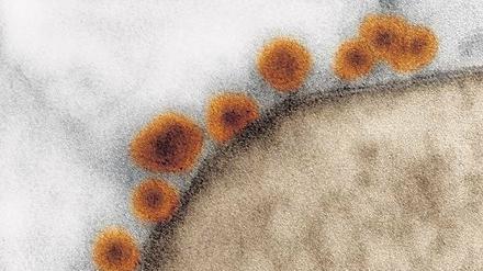 Zika