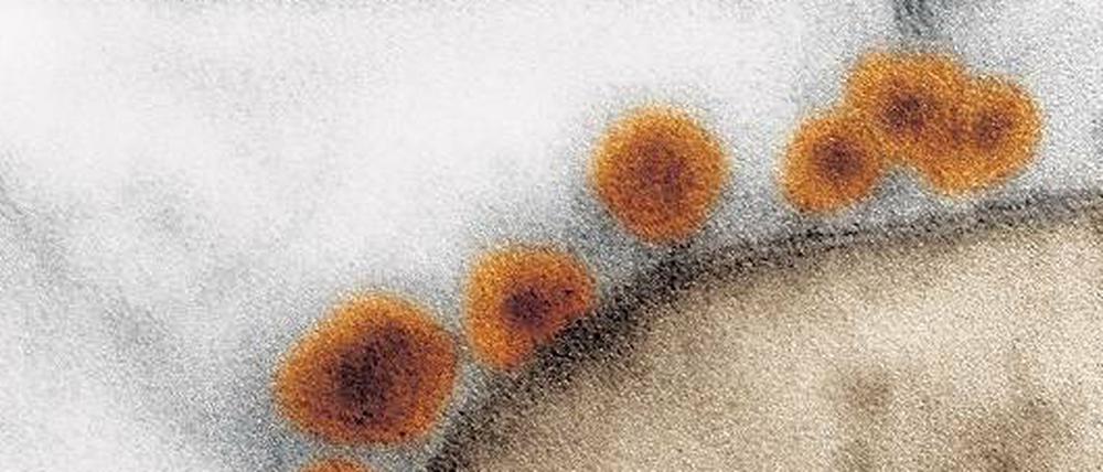 Zika