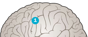 Zeit ist Hirn - bei einem Schlaganfall (1) sterben pro Minute zwei Millionen Neuronen ab. Durch einen Verschluss der Halsschlagader oder ein Blutgerinnsel in den Gehirngefäßen erhalten die Nervenzellen zu wenig Sauerstoff und Nährstoffe. Bei Verdacht sofort 112 wählen!