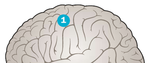 Ein epileptischer Anfall gleicht einem regelrechten Blitzgewitter im Kopf, da sich dabei Neuronengruppen in der Hirnrinde (1) synchron massiv entladen. Dabei kann infolge eines Anfalls die gesamte Hirnrinde von den Entladungen betroffen sein (generalisierte Anfälle) oder nur einzelne Stellen (fokale Anfälle). Gehirnschäden und lebensbedrohliche Verletzungen können drohen, oftmals bleibt es aber auch bei nur einem einmaligen Vorfall.