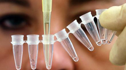 Mit einer Spezialpipette entnimmt eine Gentechnik-Expertin für einen Vaterschaftstest eine winzige Menge Flüssigkeit aus einem Probenbehälter.