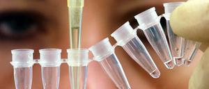 Mit einer Spezialpipette entnimmt eine Gentechnik-Expertin für einen Vaterschaftstest eine winzige Menge Flüssigkeit aus einem Probenbehälter.