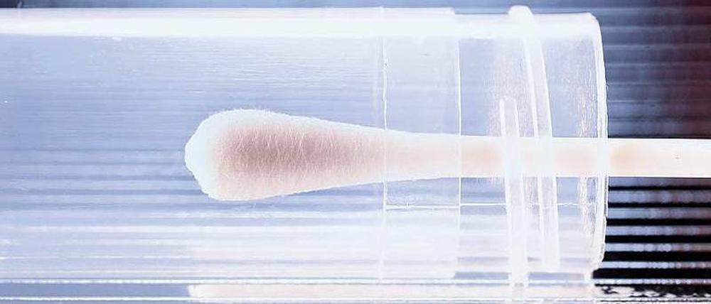Nein, das ist kein Putzzeug. Wissenschaftler untersuchen U-Bahnen. 