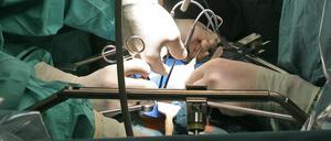 Operation für eine Spenderniere. In fast allen Krankenhäusern gibt es zwar interne Sicherheitschecks, dennoch geht manchmal etwas schief. Die Krankenkassen erhöhen deshalb kontinuierlich den Druck auf die Kliniken.