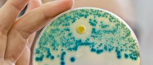 Eine Indikatorkulturplatte zum Nachweis von resistenten Bakterien.