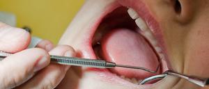 In Hamburg endete ein Besuch beim Zahnarzt tödlich. (Symbolbild)