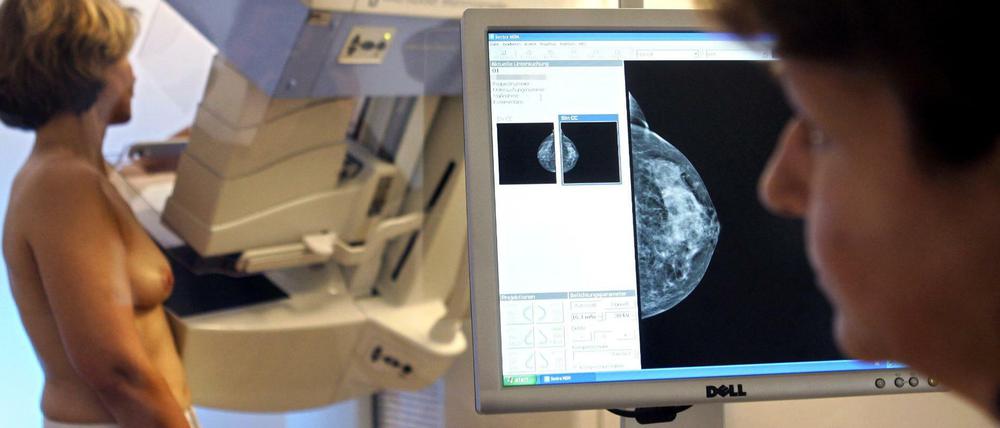 Vorsorge. Bei einer Mammografie kann Brustkrebs frühzeitig entdeckt werden - umso schonender kann dann eine Therapie sein.