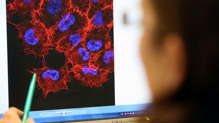 Krebsforschung. Eine neue Therapieform soll das Immunsystem von Erkrankten aktivieren und so Tumoren zerstören.
