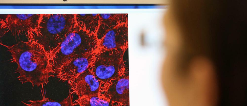 Krebsforschung. Eine neue Therapieform soll das Immunsystem von Erkrankten aktivieren und so Tumoren zerstören.