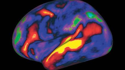 Denkorgan bei der Arbeit. Diese Kernspin-Aufnahme („Hirnscanner“) zeigt, welche Areale beim Hören von Geschichten aktiv sind. Rot und gelb stehen für angeregte, grün und blau für nicht aktive Gebiete.