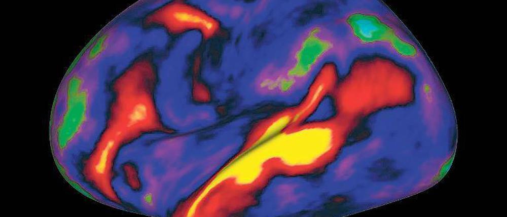 Denkorgan bei der Arbeit. Diese Kernspin-Aufnahme („Hirnscanner“) zeigt, welche Areale beim Hören von Geschichten aktiv sind. Rot und gelb stehen für angeregte, grün und blau für nicht aktive Gebiete. 