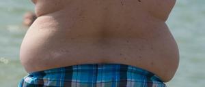 Zu viel auf den Rippen. Immer mehr Deutsche leiden unter Fettleibigkeit.