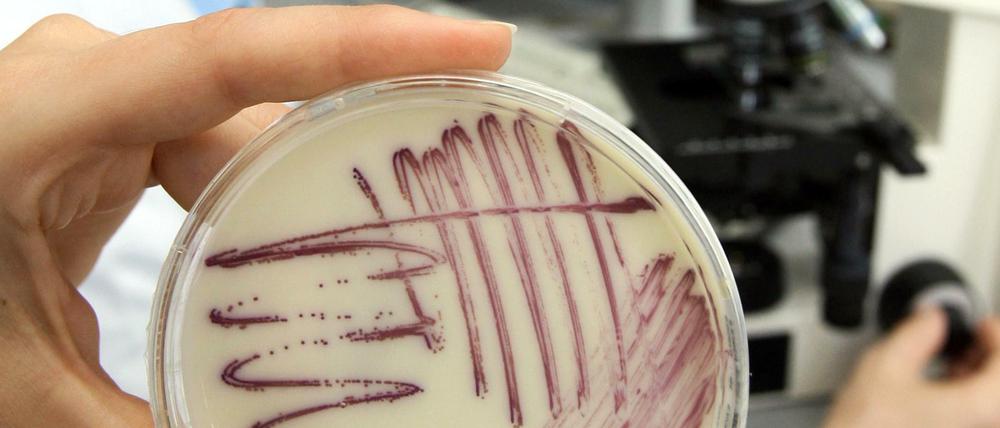 Gefährliche Erreger. Eine Petrischale mit MRSA-Keimen (Methicillin-resistenten Staphylococcus aureus).