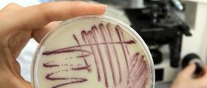 Gefährliche Erreger. Eine Petrischale mit MRSA-Keimen (Methicillin-resistenten Staphylococcus aureus). 