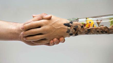 Prothesen werden immer individueller - auch optisch. Vor allem aber sind sie weit funktionaler als früher.