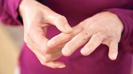 Das schmerzt. Arthrose in den Fingern macht vielen zu schaffen. 