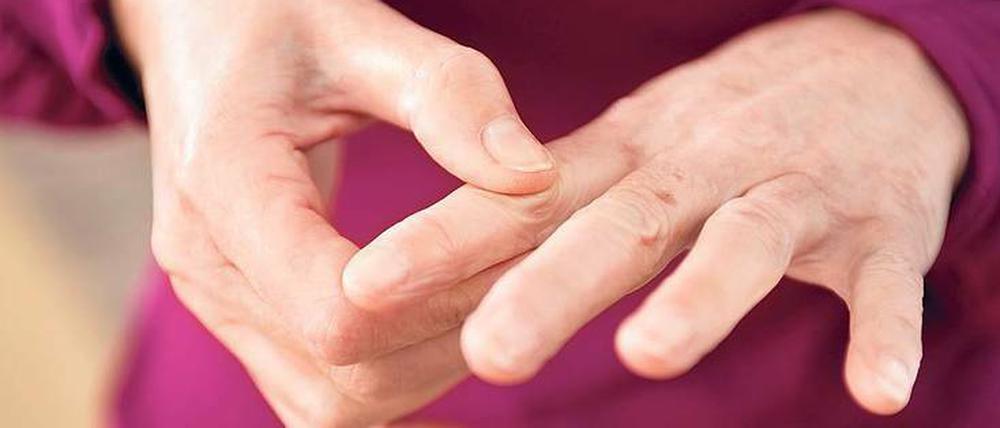 Das schmerzt. Arthrose in den Fingern macht vielen zu schaffen.