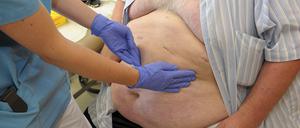 Eine Chirurgin führt im Stadtkrankenhaus Schwabach eine Nachuntersuchung an einem Adipositas-Patienten durch.