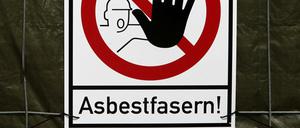 Unsichtbare Gefahr. Asbestfasern erhöhen das Risiko für ein Mesotheliom, eine besonders aggressive Geschwulst.