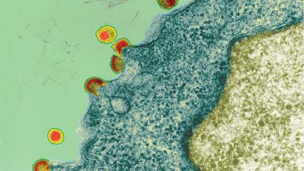 Ungebremst. Ohne Krankenversicherung oder Papiere ist für HIV-Infizierte der Zugang zu Medikamenten schwierig.