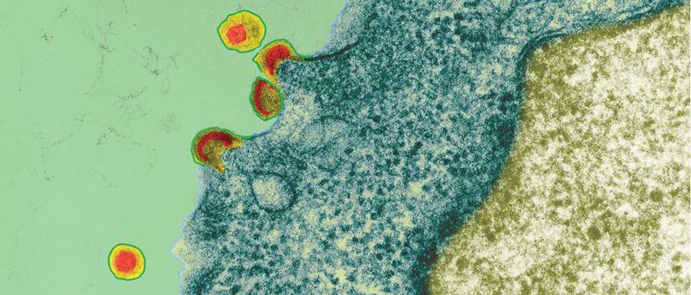 Ungebremst. Ohne Krankenversicherung oder Papiere ist für HIV-Infizierte der Zugang zu Medikamenten schwierig.