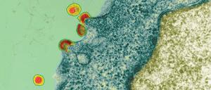 Ungebremst. Ohne Krankenversicherung oder Papiere ist für HIV-Infizierte der Zugang zu Medikamenten schwierig.