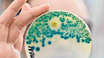 Tückisch. Über die Folgen von Antibiotika-Resistenzen gibt es keine seriösen Hochrechnungen. 