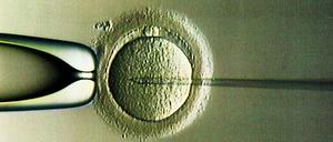 Großbritannien lässt das Austragen von Kindern mit drei Elternteilen zu.