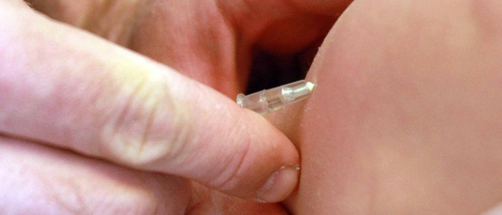 Ein kleiner Pieks mit großer Wirkung. Die Masernimpfung schützt zuverlässig vor der gefährlichen Krankheit.
