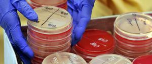 Hartnäckig. Klebsiellen sind nicht nur schwer behandelbar. Sie überleben auch besonders gut auf Oberflächen.