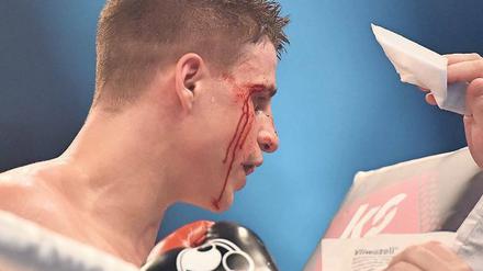 So sehen Sieger aus (II). Tyron Zeuge, gezeichnet von einem Kopfstoß seines Gegners Isaac Ekpo.