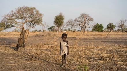 Ein Junge namens Giel trägt im vom Hunger bedrohten Südsudan ein weißes Plastikband am Knöchel. Es zeigt an, dass er an einer ambulanten Therapie teilgenommen hat. 