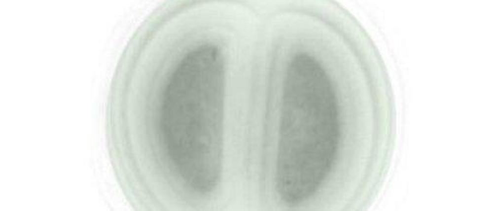 Wer hat's erfunden? Die Photosynthese entwickelte sich nur einmal in Milliarden von Jahren Evolution in Cyanobakterien (hier ein Oxyphotobakterium), auch Blaualgen genannt. Höhere Pflanzen haben sich diese Fähigkeit nur "einverleibt".