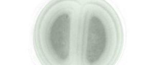 Wer hat's erfunden? Die Photosynthese entwickelte sich nur einmal in Milliarden von Jahren Evolution in Cyanobakterien (hier ein Oxyphotobakterium), auch Blaualgen genannt. Höhere Pflanzen haben sich diese Fähigkeit nur "einverleibt".