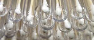 874 Frauen erschienen zum Speicheltest. Dabei kamen solche Spurensicherungsröhrchen zum Einsatz.