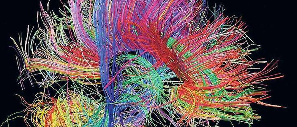 Buntes Durcheinander. Wenn bei Parkinson-Patienten die Dopamin-produzierenden Zellen im Gehirn sterben, dann kommen die Impulse zwischen den vernetzten Nervenzellen im Gehirn durcheinander und die Bewegungen geraten ins Stocken.