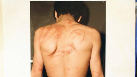 Die Opfer zuerst. Die Polizei startete Informationskampagnen, die vielen Berlinern die Augen öffneten.