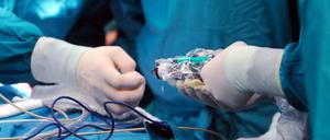 Berlins Krankenhäuser sind überlastet. Am Montag muss sich Gesundheitssenatorin Dilek Kolat (SPD) Fragen der Opposition stellen.  
