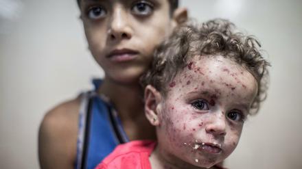Für viele verletzte Kinder gibt es im Gazastreifen keine Behandlungsmöglichkeiten.