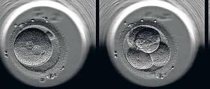 Strafsache Embryo. Es ist nur ein kleiner Schritt für einen menschlichen Embryo vom Vorkernstadium (links), in dem das Erbgut der Eltern noch getrennt ist, bis zum vierzelligen Embryo (Mitte), rund 20 Stunden später. Doch für Reproduktionsmediziner ist es ein großer Unterschied, der über die Legalität einer Embryonenspende entscheidet.