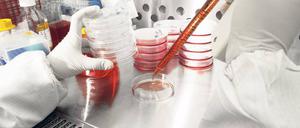 Stammzellen sind die Basis für künftige Zelltherapien, mit denen Forscher am noch zu bauenden Berlin Center for Advanced Therapies (BECAT) Krankheiten wie Krebs behandeln wollen.