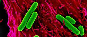 Fotosynthetisch aktive Blaualgen (Synechococcus elongatus) können Herzmuskelzellen einer Ratte mit Sauerstoff versorgen. 